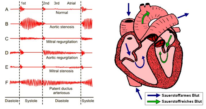 Abb.3: Phonokardiogramme von Herztönen; Abb.4: Zeichnung eines Herzens
