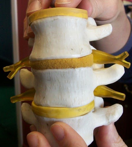 Abb 2: Modell von Wirbeln (weiß) und Bandscheiben (gelber Schwamm) und Nerven (gelb)